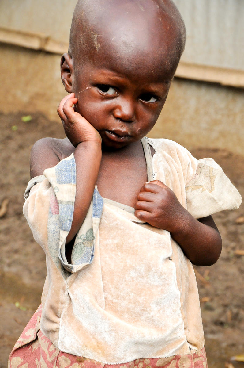 Child stands outside in the DRC, with hand to face